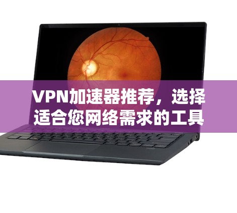 VPN加速器推荐，选择适合您网络需求的工具